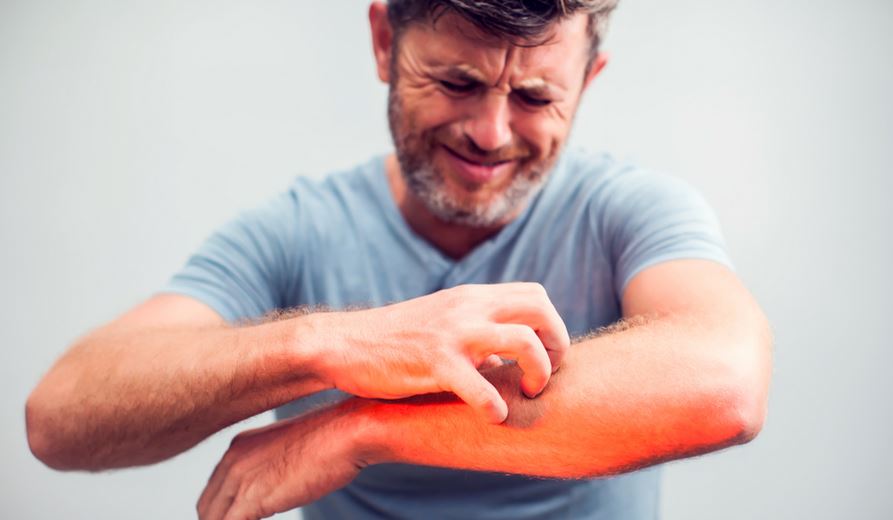 Berbahayakah Kulit Gatal ?