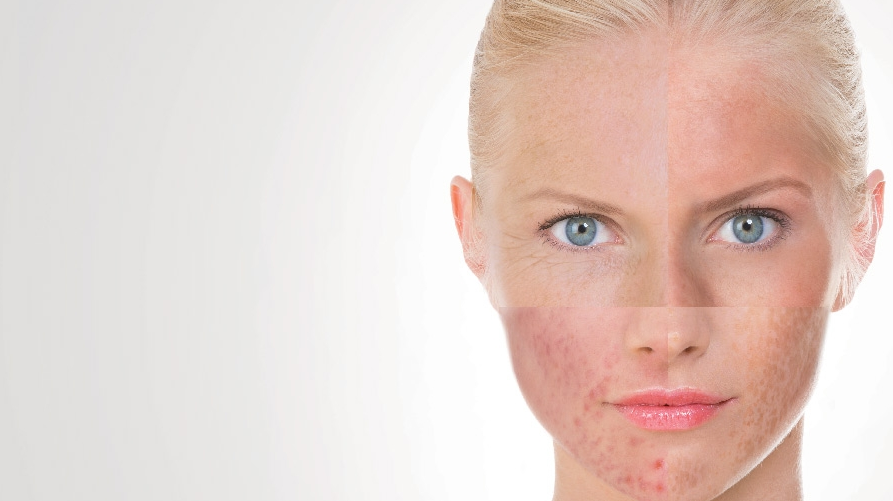 cara memilih sabun cuci muka sesuai jenis kulit sensitif